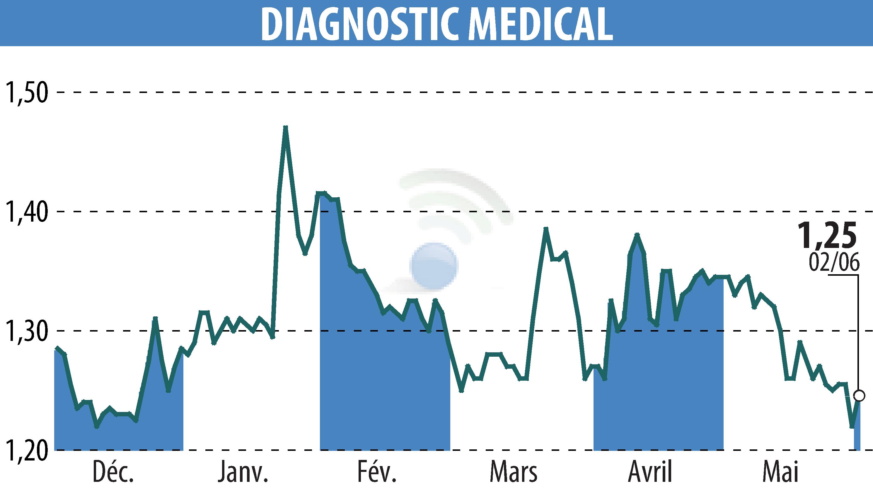 Stock price chart of DIAGNOSTIC MEDICAL (EPA:ALDMS) showing fluctuations.