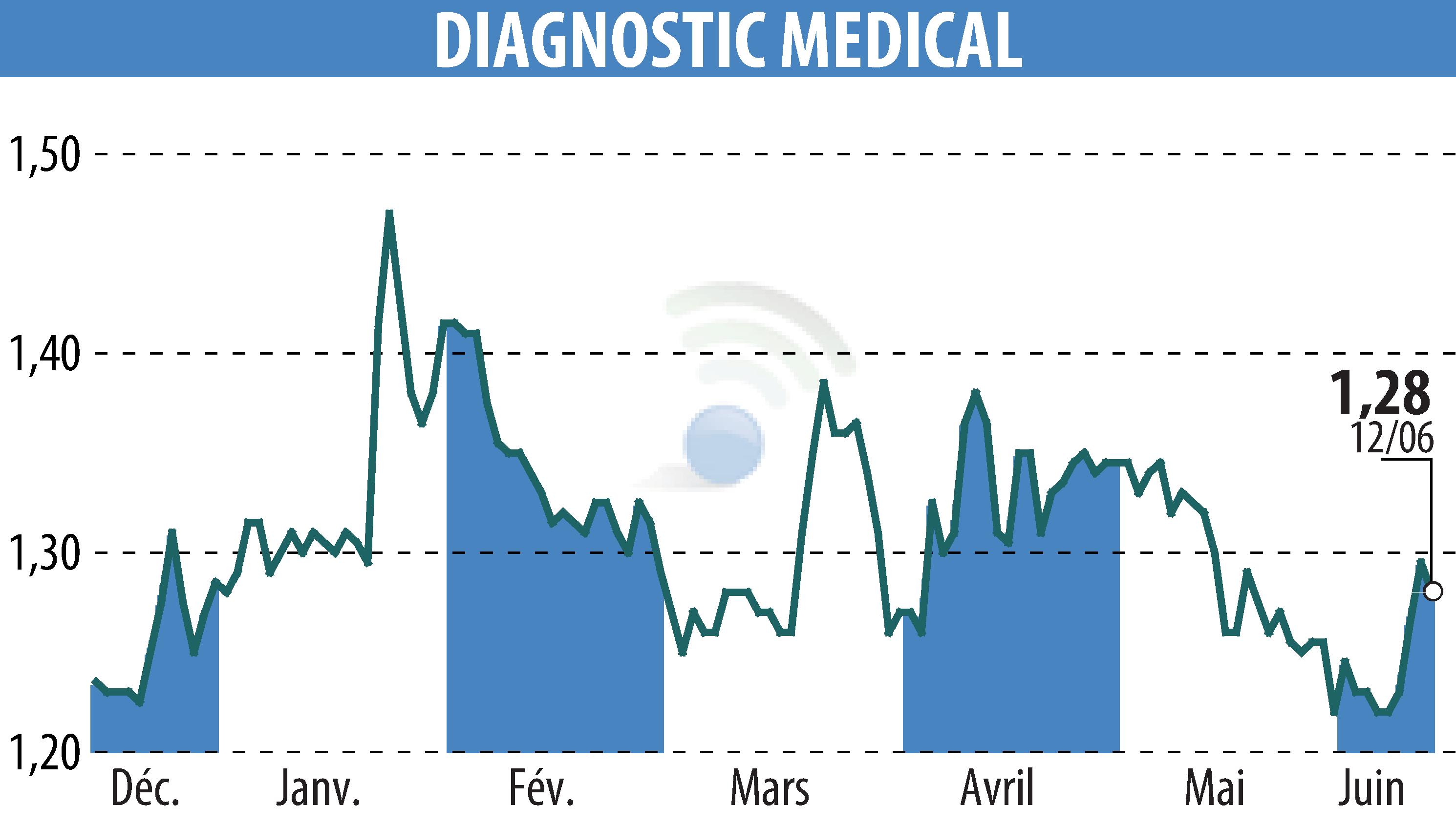 Stock price chart of DIAGNOSTIC MEDICAL (EPA:ALDMS) showing fluctuations.
