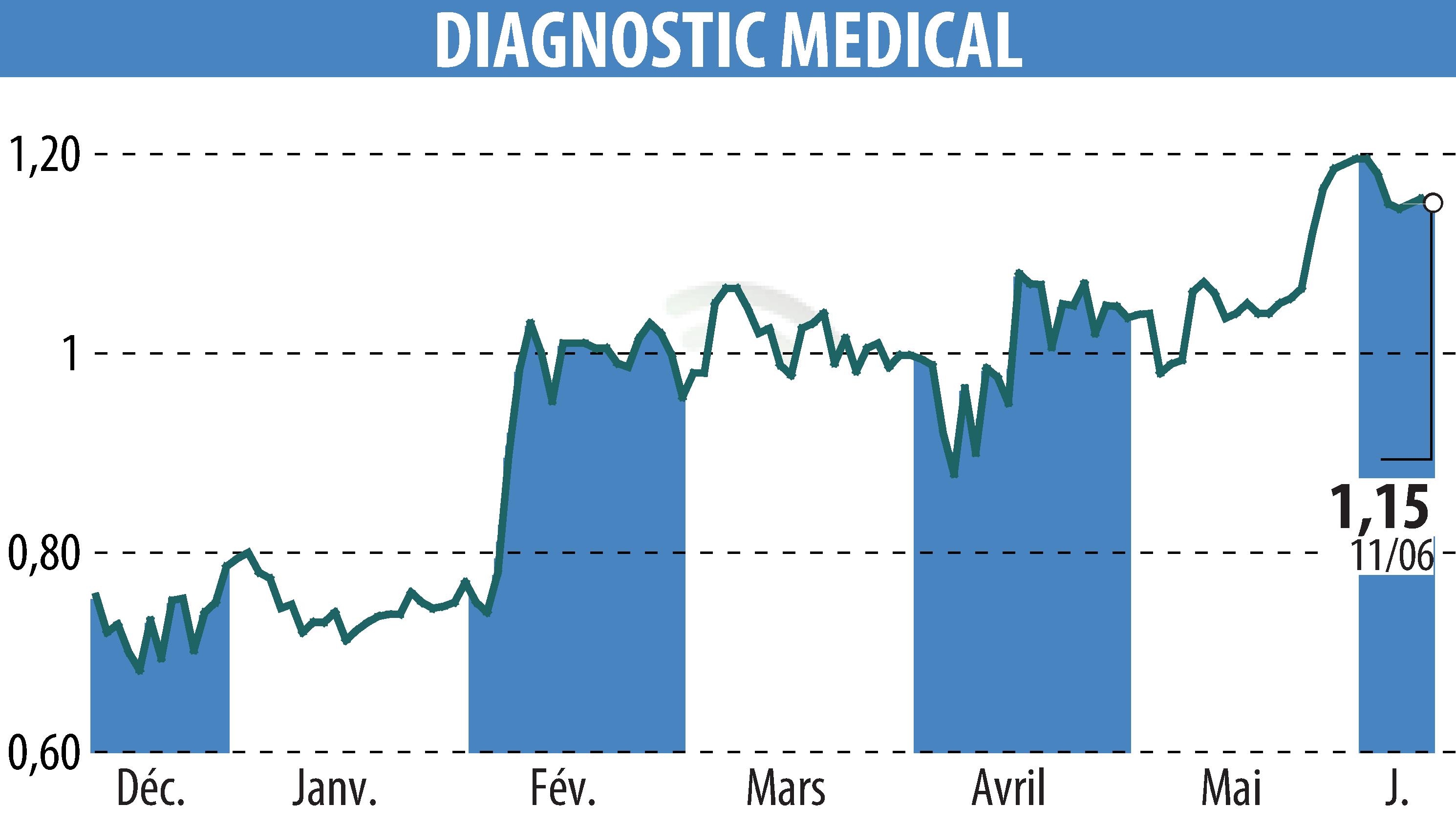 Stock price chart of DIAGNOSTIC MEDICAL (EPA:ALDMS) showing fluctuations.