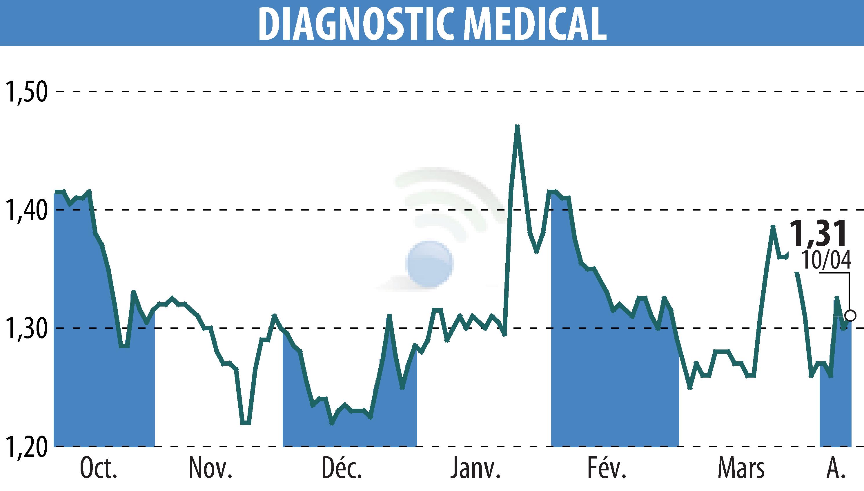 Stock price chart of DIAGNOSTIC MEDICAL (EPA:ALDMS) showing fluctuations.