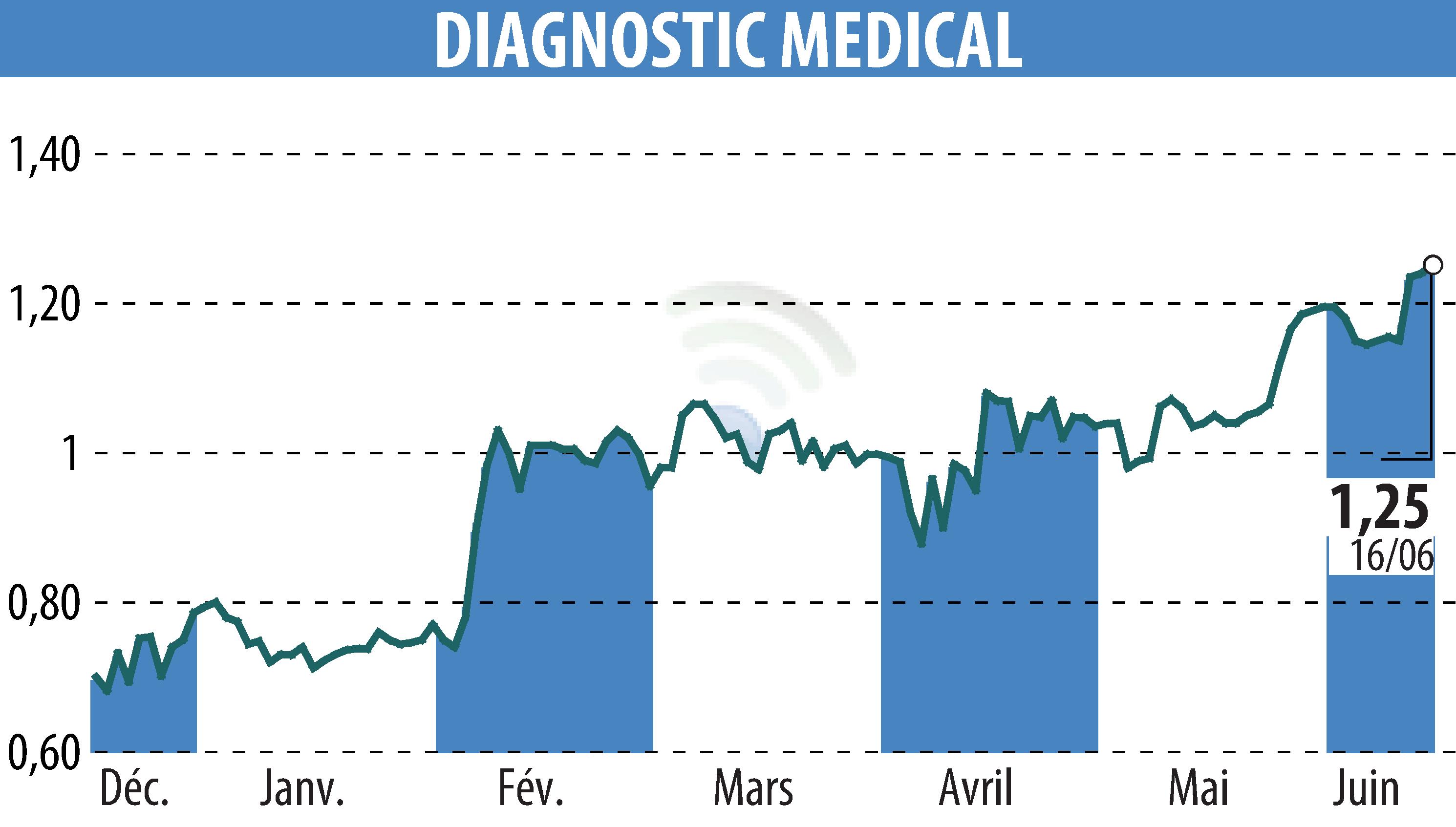 Stock price chart of DIAGNOSTIC MEDICAL (EPA:ALDMS) showing fluctuations.