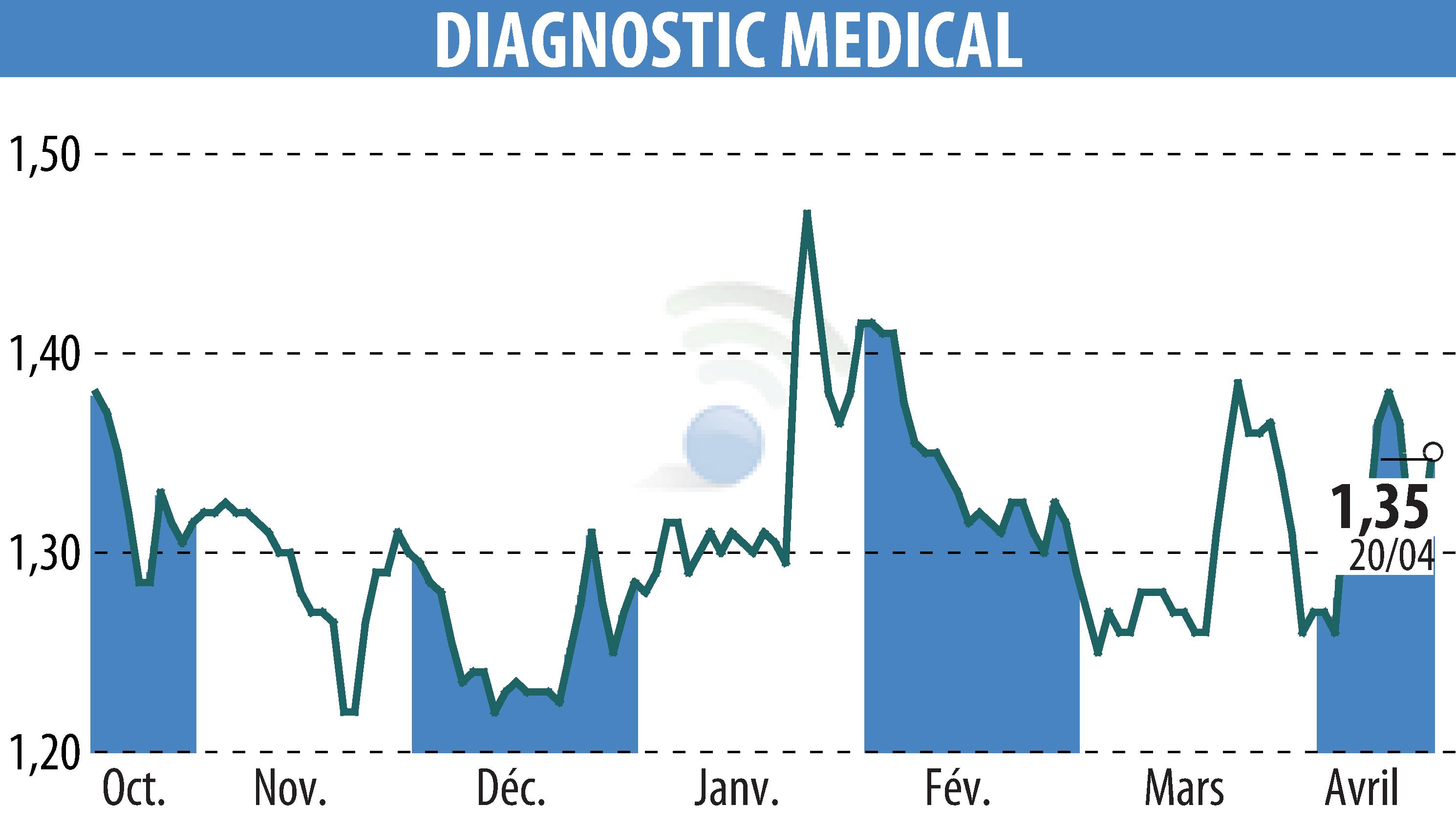 Stock price chart of DIAGNOSTIC MEDICAL (EPA:ALDMS) showing fluctuations.