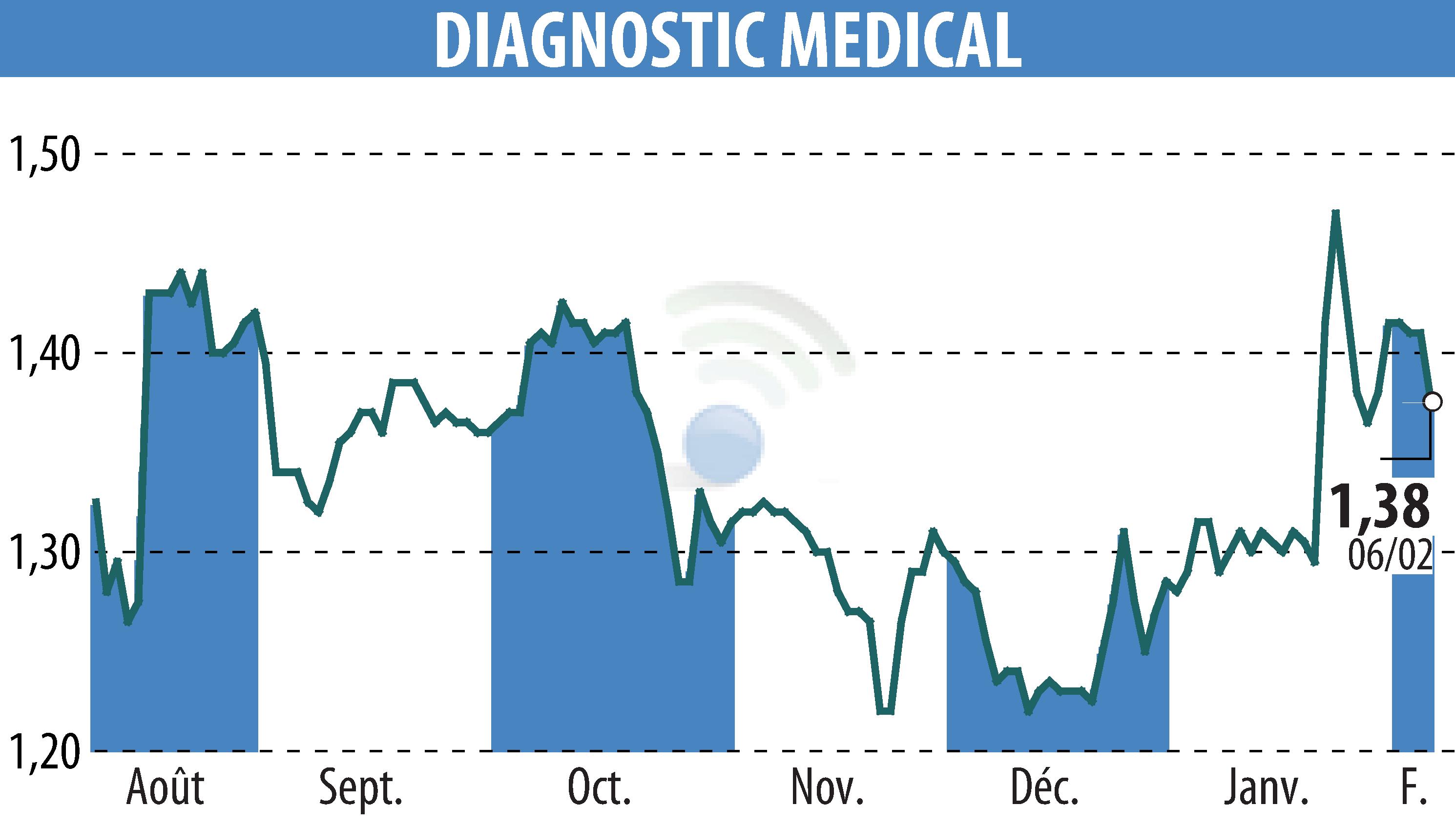 Stock price chart of DIAGNOSTIC MEDICAL (EPA:ALDMS) showing fluctuations.