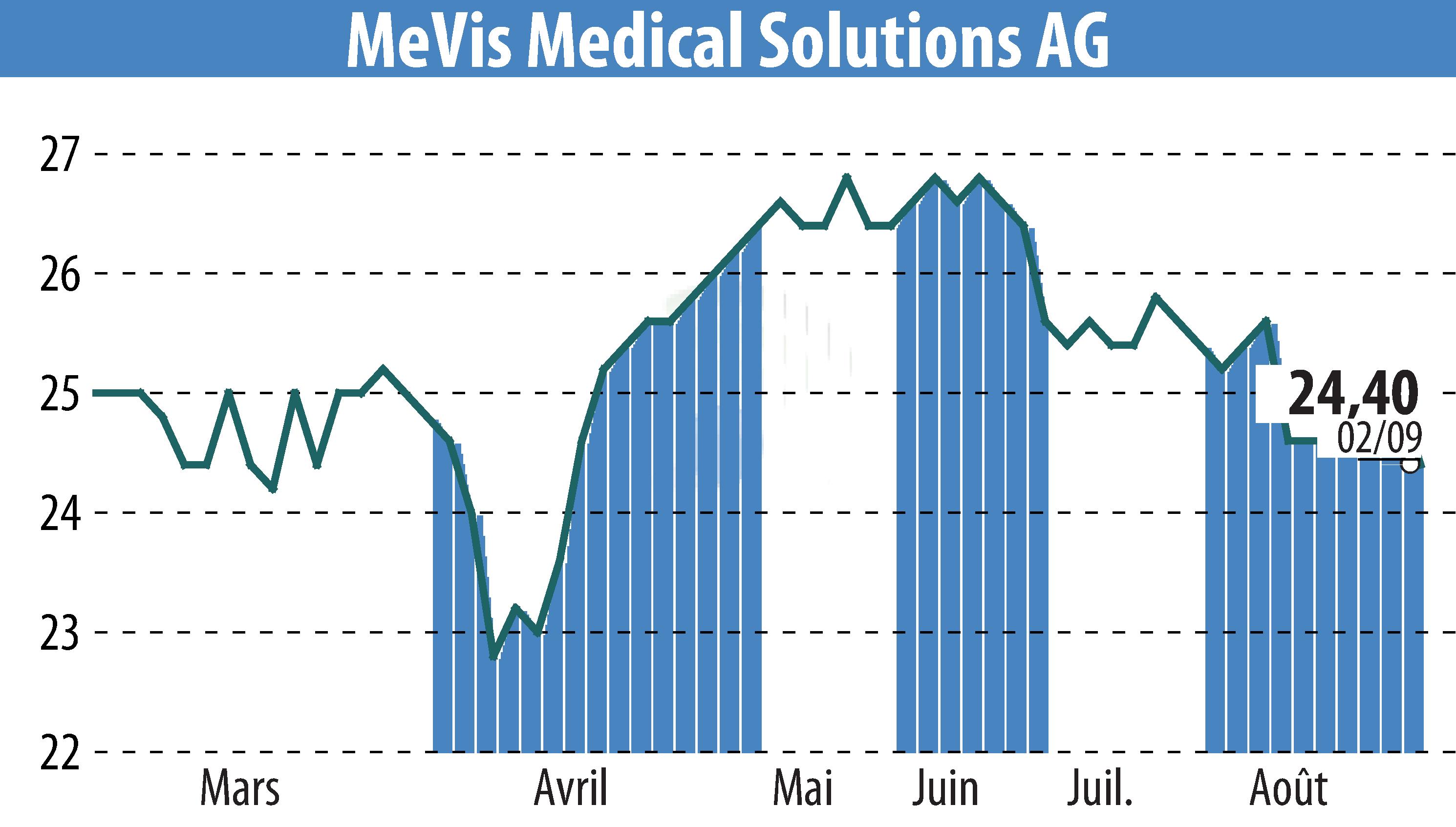 Stock price chart of MeVis Medical Solutions AG (EBR:M3V) showing fluctuations.